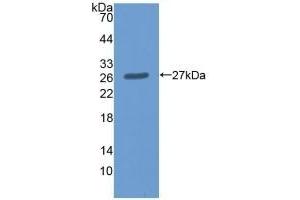 Detection of Recombinant ME2, Human using Polyclonal Antibody to Malic Enzyme 2, NADP+ Dependent, Mitochondrial (ME2) (Malic Enzyme 2, NADP+ Dependent, Mitochondrial (AA 220-426) anticorps)