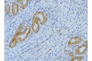 ABIN6275364 at 1/100 staining Human uterus tissue by IHC-P. (SERPING1 anticorps  (Internal Region))