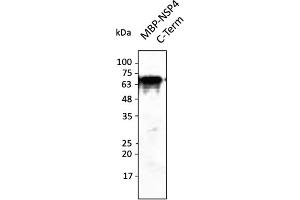 Western Blotting (WB) image for anti-SARS-CoV-2 Non-Structural Protein 4 (NSP4) (C-Term) antibody (ABIN7272999) (SARS-CoV-2 NSP4 anticorps  (C-Term))