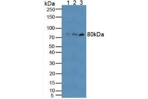 Western blot analysis of (1) Human RAW2647 Cells, (2) Human HT-1080 Cells and (3) Human Blood Cells. (TLR6 anticorps  (AA 608-796))