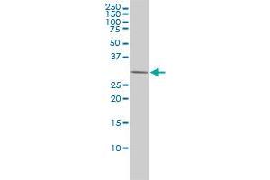 PRKAB2 monoclonal antibody (M01), clone 2G9 Western Blot analysis of PRKAB2 expression in Hela .