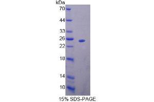 SDS-PAGE analysis of Mouse MTF1 Protein. (MTF1 Protéine)