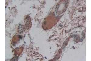 Detection of CPB2 in Mouse Skin Tissue using Polyclonal Antibody to Carboxypeptidase B2 (CPB2)