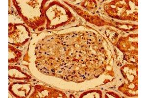 Immunohistochemistry of paraffin-embedded human kidney tissue using ABIN7161298 at dilution of 1:100 (NOTCH2 anticorps  (AA 59-250))