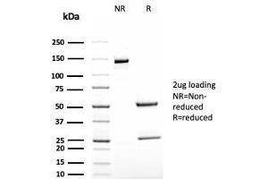 anti-TAG-72 / CA72.4 antibody