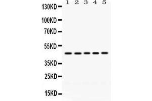 Anti- PGK1 Picoband antibody, Western blottingAll lanes: Anti PGK1  at 0. (PGK1 anticorps  (C-Term))
