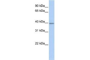 WB Suggested Anti-TXNIP Antibody Titration: 0.