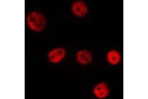 ABIN6275604 staining Hela by IF/ICC.