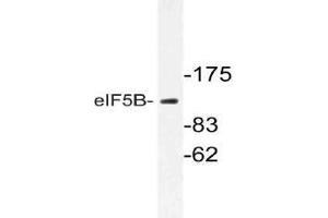 Western blot (WB) analysis of eIF5B antibody in extracts from Jurkat cells. (EIF5B anticorps)