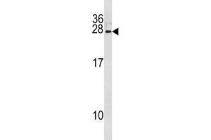 Western Blotting (WB) image for anti-Interferon, alpha 8 (IFNA8) antibody (ABIN3004546)