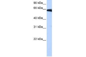 WB Suggested Anti-PIGW Antibody Titration:  0. (PIGW anticorps  (Middle Region))