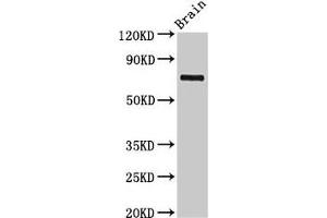 Western Blot Positive WB detected in: Rat brain tissue All lanes: L3MBTL4 antibody at 3 μg/mL Secondary Goat polyclonal to rabbit IgG at 1/50000 dilution Predicted band size: 72, 62 kDa Observed band size: 72 kDa