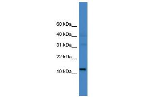 WB Suggested Anti-C14orf48 Antibody Titration: 0. (LINC00521 anticorps  (N-Term))