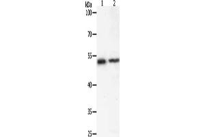 Gel: 10 % SDS-PAGE, Lysate: 40 μg, Lane 1-2: Human liver cancer tissue, 293T cells, Primary antibody: ABIN7192602(SOX1 Antibody) at dilution 1/400, Secondary antibody: Goat anti rabbit IgG at 1/8000 dilution, Exposure time: 20 seconds (SOX1 anticorps)