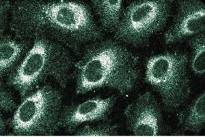 Immunofluorescent staining of Human Endothelial cells with anti-SRP54.