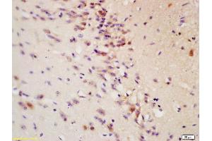 Formalin-fixed and paraffin embedded: rat brain tissue labeled with Anti-Tau protein Polyclonal Antibody , Unconjugated at 1:200 followed by conjugation to the secondary antibody and DAB staining