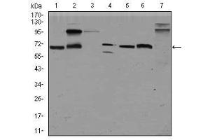 Image no. 5 for anti-Glypican 3 (GPC3) (AA 55-200) antibody (ABIN1498500) (Glypican 3 anticorps  (AA 55-200))