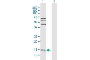 Western Blot analysis of PPIA expression in transfected 293T cell line by PPIA MaxPab polyclonal antibody. (PPIA anticorps  (AA 1-165))