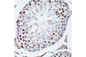 Immunohistochemistry of paraffin-embedded mouse testis using hnRNPM antibody (ABIN6128031, ABIN6141919, ABIN6141920 and ABIN6222681) at dilution of 1:100 (40x lens). (HNRNPM anticorps  (AA 491-730))