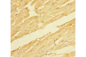 Immunohistochemistry of paraffin-embedded human heart tissue using ABIN7161234 at dilution of 1:100 (NRN1 anticorps  (AA 28-116))