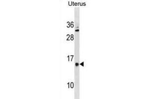 GALNTL5 Antibody (N-term) (ABIN1881361 and ABIN2838787) western blot analysis in human Uterus tissue lysates (35 μg/lane). (GALNTL5 anticorps  (N-Term))