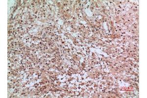 Immunohistochemistry (IHC) analysis of paraffin-embedded Human Brain, antibody was diluted at 1:100. (CD3D anticorps  (Internal Region))