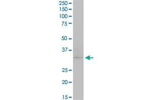 CDK4 monoclonal antibody (M03), clone 4F11.
