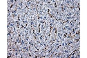 Immunohistochemical staining of paraffin-embedded liver tissue using anti-PSMC3mouse monoclonal antibody. (PSMC3 anticorps)