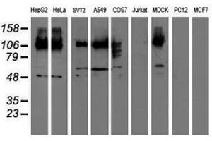 Image no. 2 for anti-CUB Domain Containing Protein 1 (CDCP1) antibody (ABIN1497412) (CDCP1 anticorps)