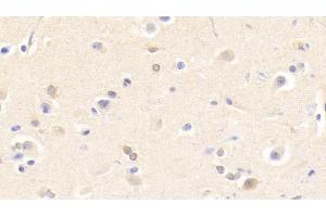 Detection of CHRNb2 in Human Cerebrum Tissue using Polyclonal Antibody to Cholinergic Receptor, Nicotinic, Beta 2 (CHRNb2)