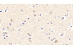 Detection of CHRNb2 in Human Cerebrum Tissue using Polyclonal Antibody to Cholinergic Receptor, Nicotinic, Beta 2 (CHRNb2) (CHRNB2 anticorps  (AA 86-244))