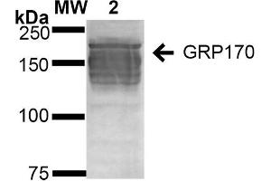 Western Blot analysis of Human Embryonic kidney epithelial cell line (HEK293) lysates showing detection of ~170 kDa GRP170 protein using Mouse Anti-GRP170 Monoclonal Antibody, Clone 6G7-2H5 (ABIN2868658).