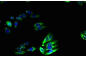 Immunofluorescent analysis of HepG2 cells using ABIN7172105 at dilution of 1:100 and Alexa Fluor 488-congugated AffiniPure Goat Anti-Rabbit IgG(H+L)