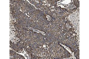 IHC analysis of NSF using anti-NSF antibody (ABIN7601630).