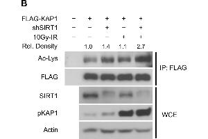 SIRT1 deacetylates KAP1 in vitro and in vivo.