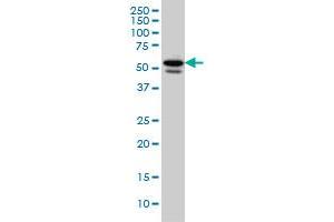 TBL1XR1 monoclonal antibody (M01A), clone 3G7 Western Blot analysis of TBL1XR1 expression in HeLa . (TBL1XR1 anticorps  (AA 81-178))