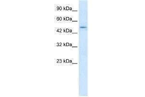 WB Suggested Anti-ZNF651 Antibody Titration:  2. (ZBTB47 anticorps  (N-Term))