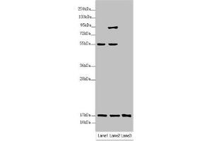 Western blot All lanes: UXT antibody at 3. (UXT anticorps  (AA 1-157))