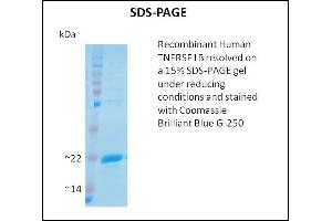 SDS-PAGE (SDS) image for Tumor Necrosis Factor Receptor Superfamily, Member 1B (TNFRSF1B) (Active) protein (ABIN5509485)