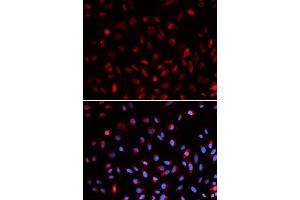 Immunofluorescence analysis of U2OS cells using ERCC1 antibody.