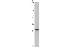 Gel: 6 % SDS-PAGE, Lysate: 40 μg, Lane: Human fetal brain tissue, Primary antibody: ABIN7130066(LBR Antibody) at dilution 1/300, Secondary antibody: Goat anti rabbit IgG at 1/8000 dilution, Exposure time: 3 minutes (Lamin B Receptor anticorps)