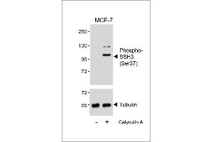 Western blot analysis of lysates from MCF-7 cell line, untreated or treated with Calyculin A, 100nM, using (ABIN6241058 and ABIN6578964) (upper) or Tubulin (lower). (SSH3 anticorps  (pSer37))