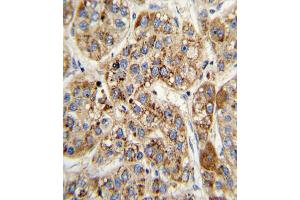Immunohistochemistry (IHC) image for anti-Methylcrotonoyl-CoA Carboxylase 2 (Beta) (MCCC2) antibody (ABIN3002883)