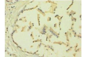 Immunohistochemistry of paraffin-embedded human plastate using TIMP1 Antibody at a dilution of 1:100. (TIMP1 anticorps  (AA 24-207))