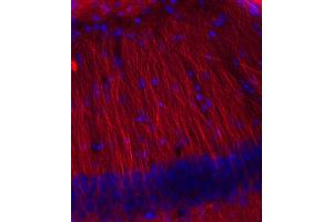 Immunohistochemistry (IHC) image for anti-Tubulin, beta 3 (TUBB3) (AA 443-450) antibody (ABIN1742554)