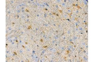 ABIN6262093 and ABIN6268791 at 1/100 staining Rat brain tissue by IHC-P.