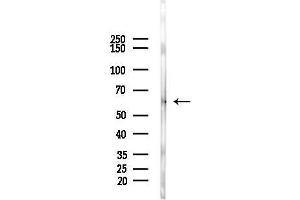 anti-Myosin Phosphatase rho Interacting Protein (MPRIP) (pThr187) antibody