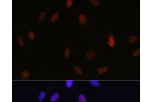 Immunofluorescence analysis of U-2 OS cells using MonoMethyl-Histone H3-K14 Polyclonal Antibody at dilution of 1:100 (40x lens). (Histone 3 anticorps  (meLys14))