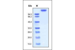 SDS-PAGE (SDS) image for Leukemia Inhibitory Factor Receptor alpha (LIFR) (AA 45-833) (Active) protein (Fc Tag) (ABIN2444162)