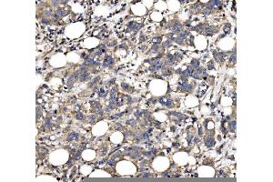 IHC analysis of QSOX2 using anti-QSOX2 antibody (ABIN7599640). (QSOX2 anticorps  (AA 102-523))